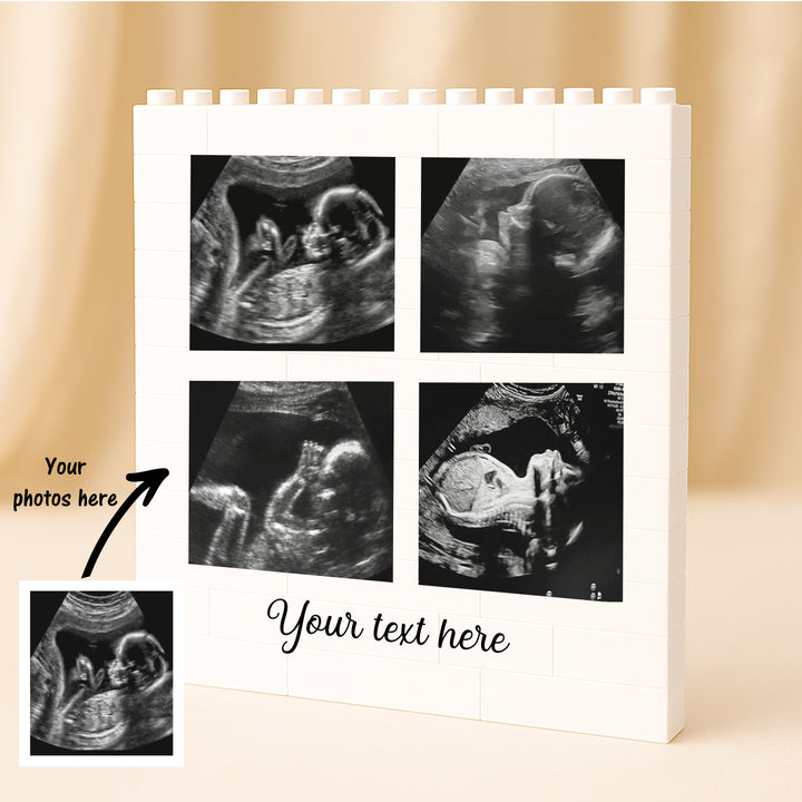 Personalised Baby Scan Building Blocks