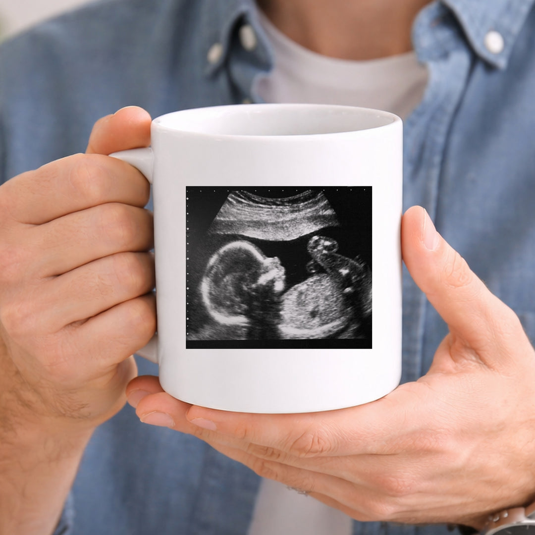 Personalised Baby Scan Happy Father's Day Daddy Mug
